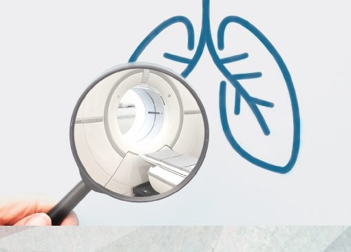 肺癌篩查 - 低劑量胸腔電腦斷層掃描