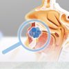 Take2 Prophecy™ Early Nasopharyngeal Cancer Screening
