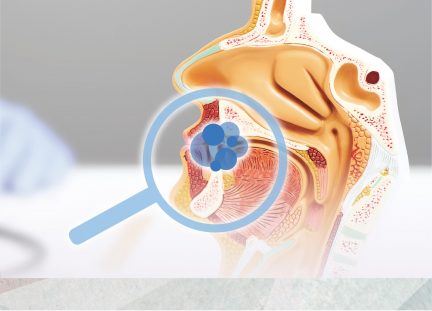 Take2 Prophecy™早期鼻咽癌篩查計劃